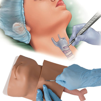 Advanced Cricothyrotomy Task Trainer