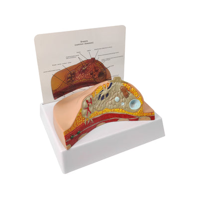 Anatomy Breast Model Showing Detailed Cross Section