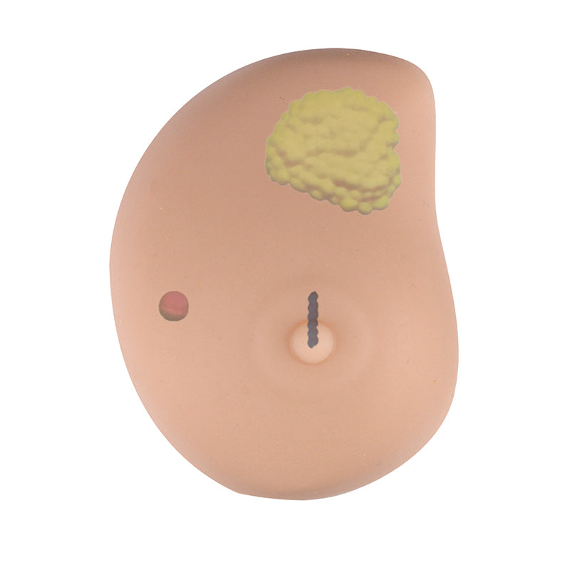 Breast Health Training Model With Lump Simulator