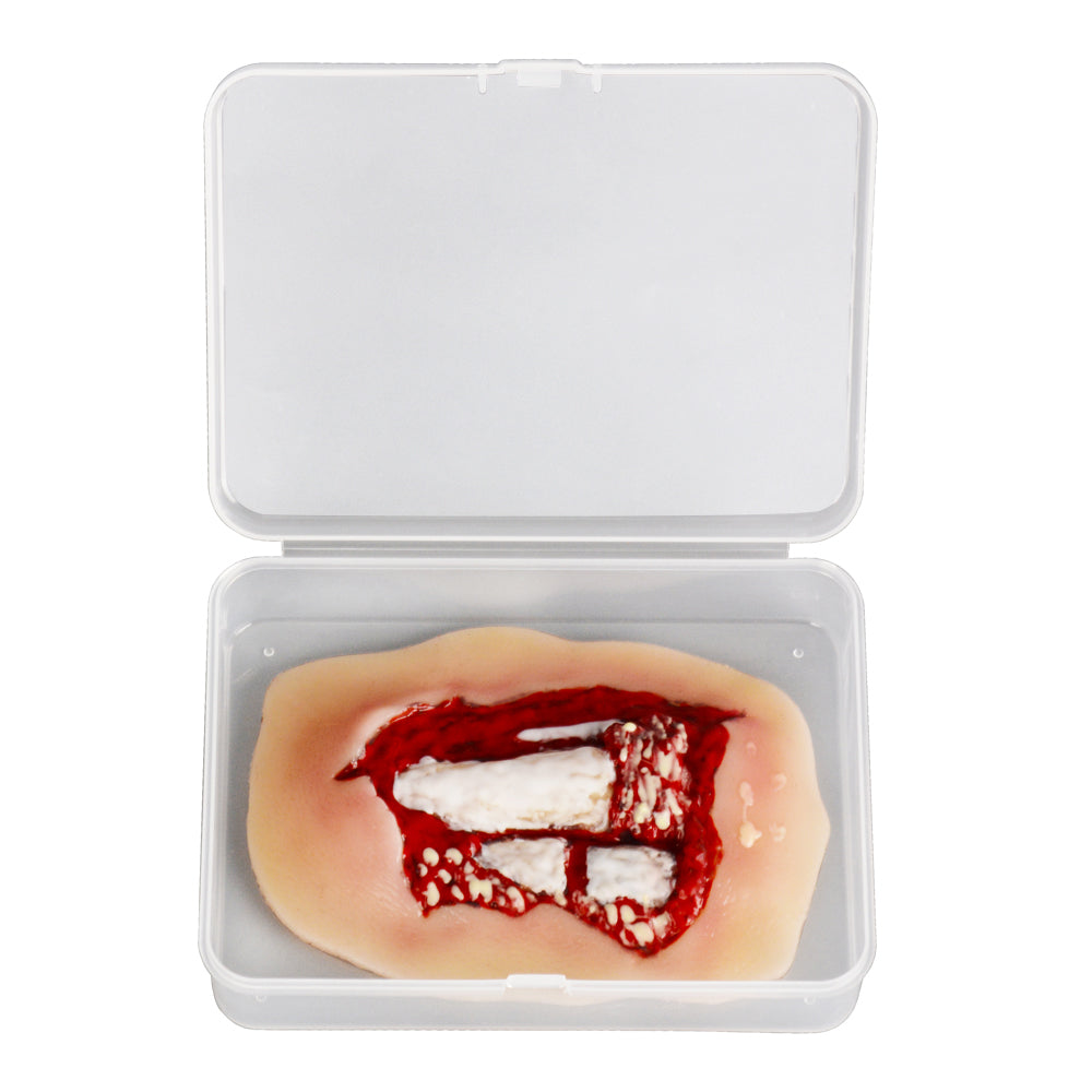 Wound Moulage - Leg Trauma Simulation Model