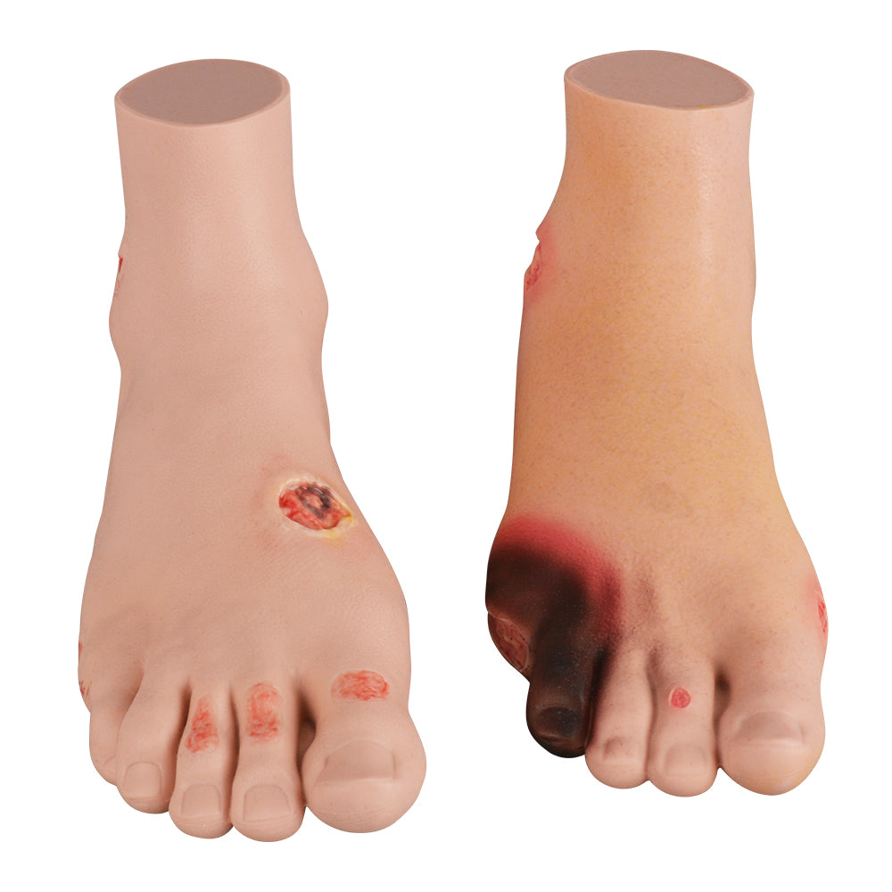 Diabetic Foot Model For Teaching Demonstration