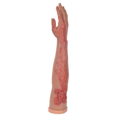 Multi Degree Burn Training Arm For Nursing Practice