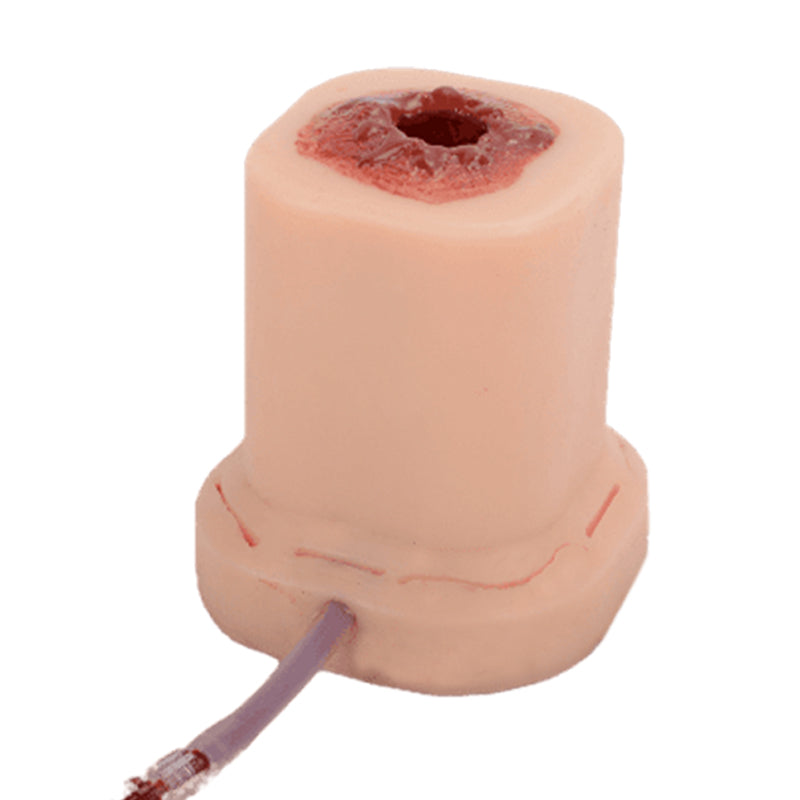 wound-pack-simulator