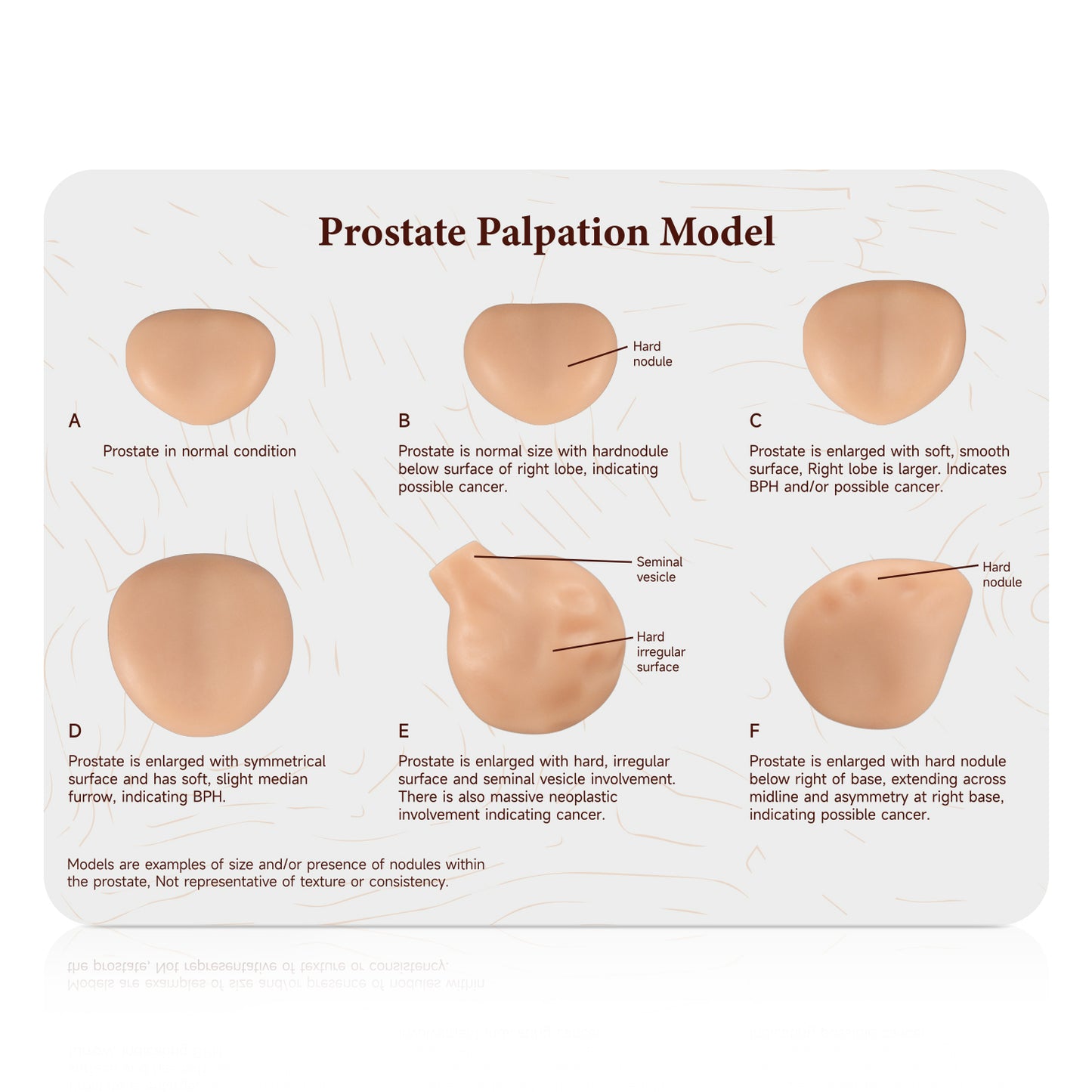 Prostate Palpation Trainer With Instruction Card Stand