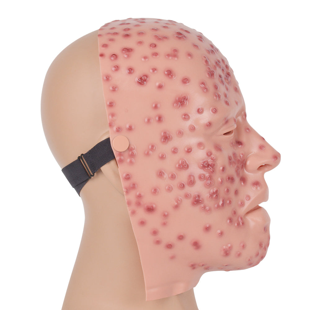 Severe Smallpox Face Model with Wearable Design