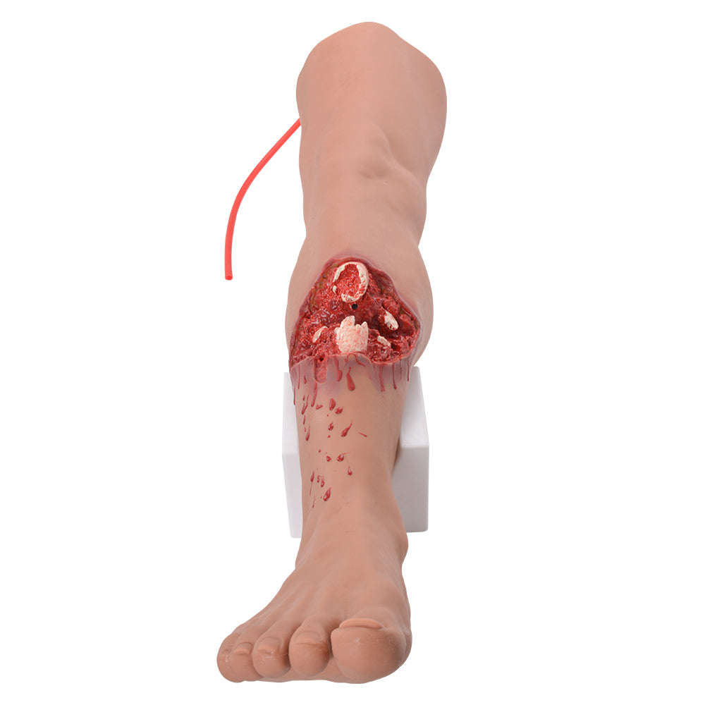 Simulated Tibial Bone Exposed Wound Practice
