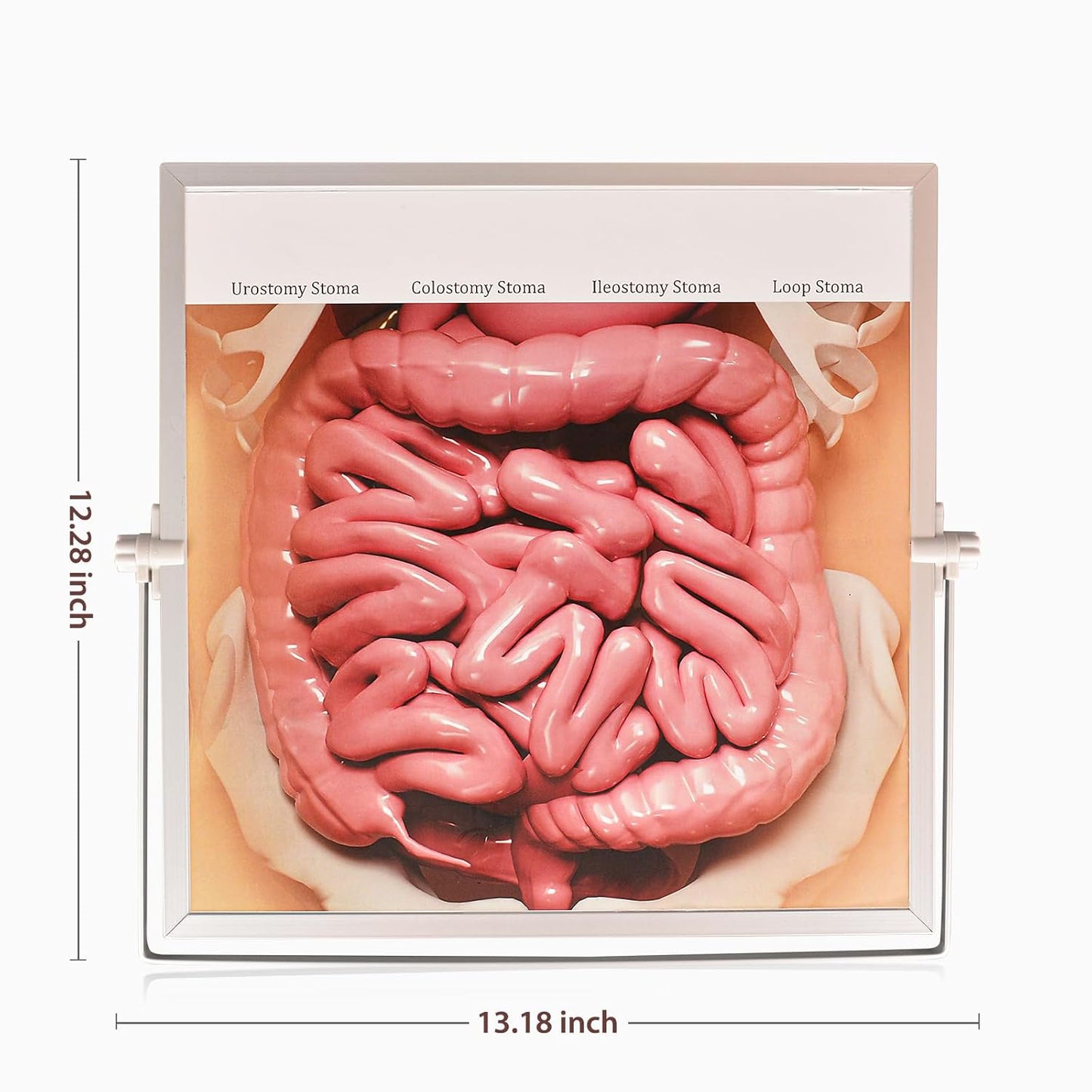 The Size of Ostomy Care Education Model
