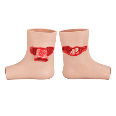 Wearable Ankle Fracture Injury Training Model