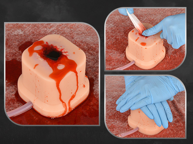 How to Pack a Wound?