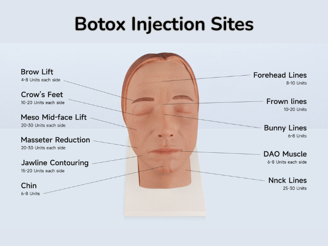 Botox Injection Sites
