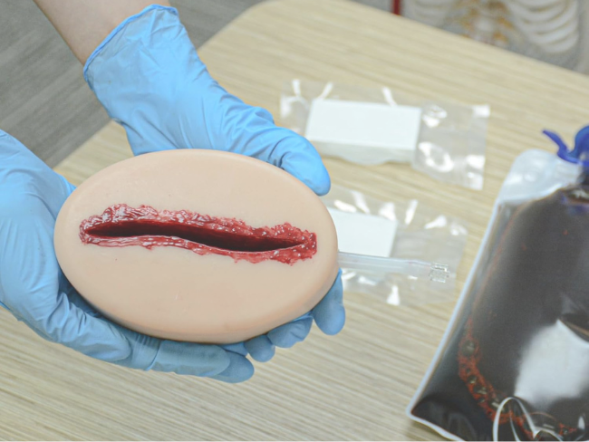 Types of Laceration Wounds: Different Types and How They Occur