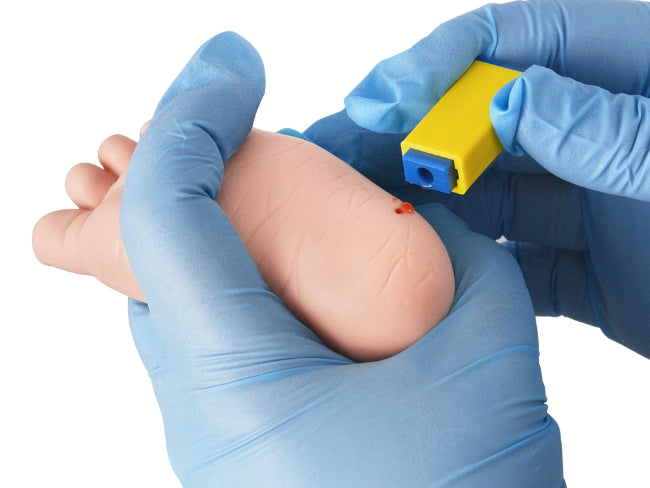 Heel Stick in Newborns