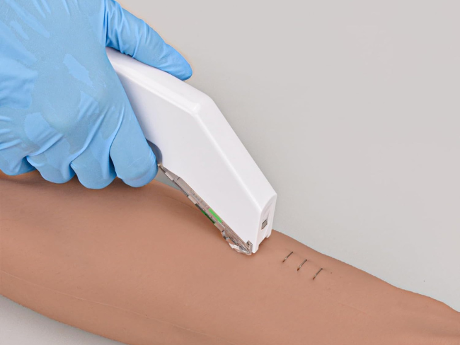 Skin Stapler Explained: Uses, Advantages, and Comparison with Sutures