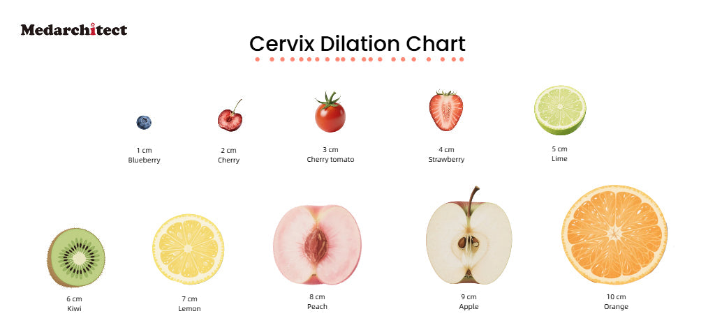 Cervical Dilation Chart