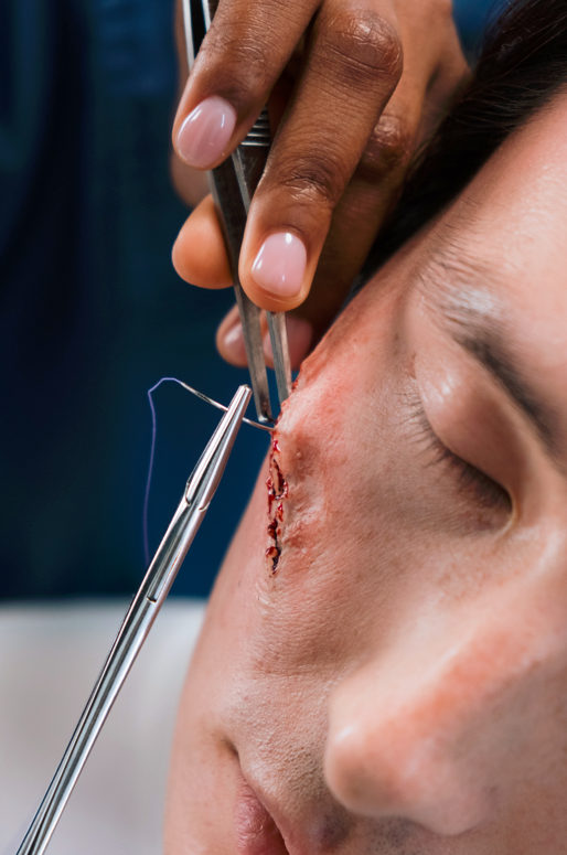 How to Suture a Wound