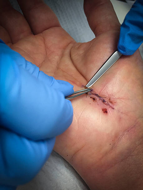 Mastering Suturing Techniques: The Importance of Preparing with an Advanced Suture Practice Kit