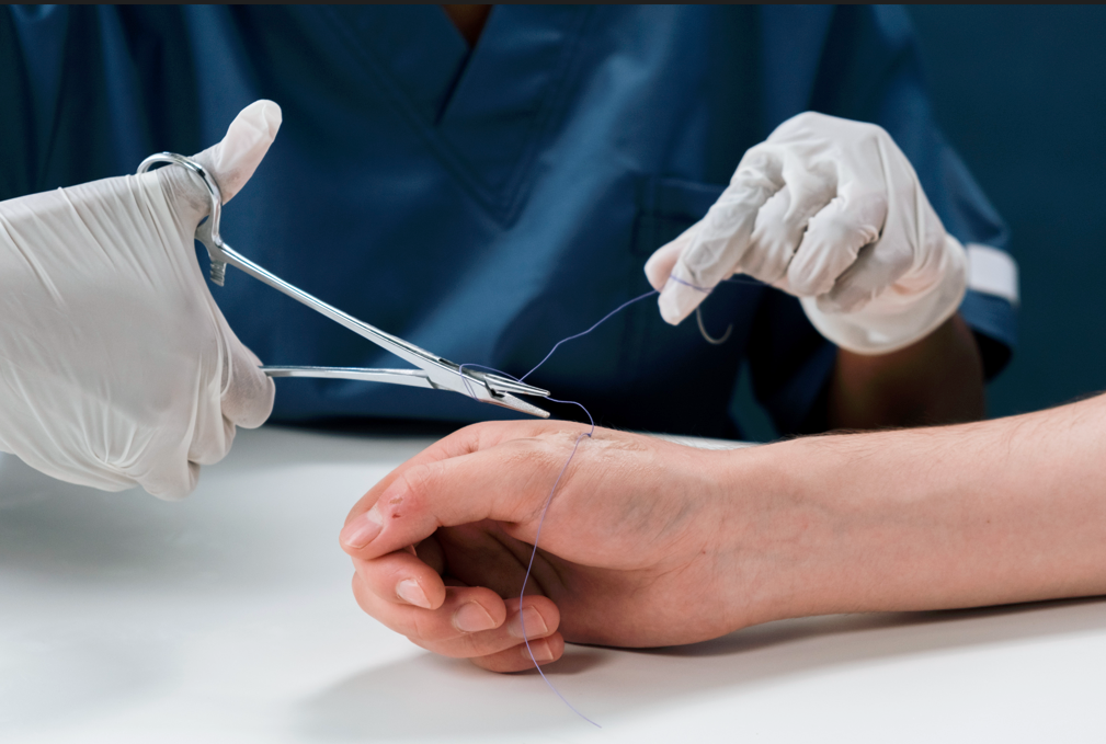 Medical Stitching How to Suture Like a Surgeon: A Step-by-Step Guide – Medarchitect