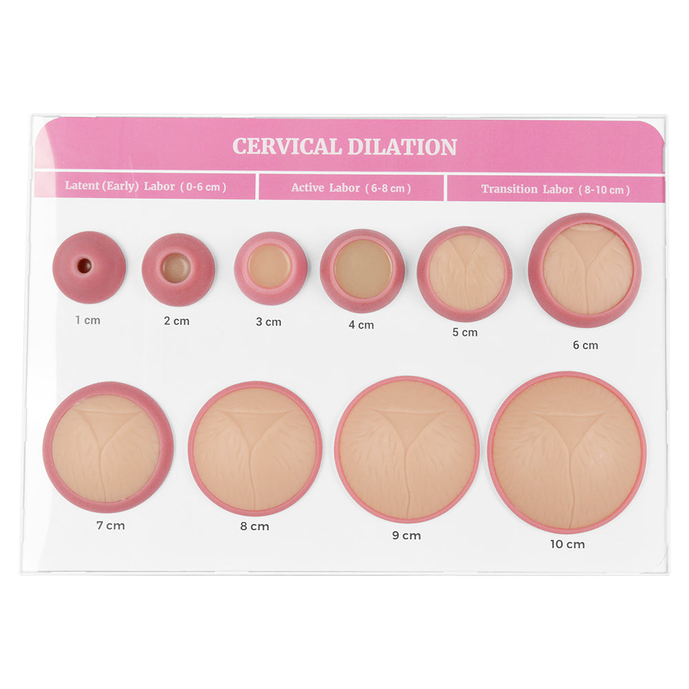Dilation Model Cervical Dilation Model – Medarchitect