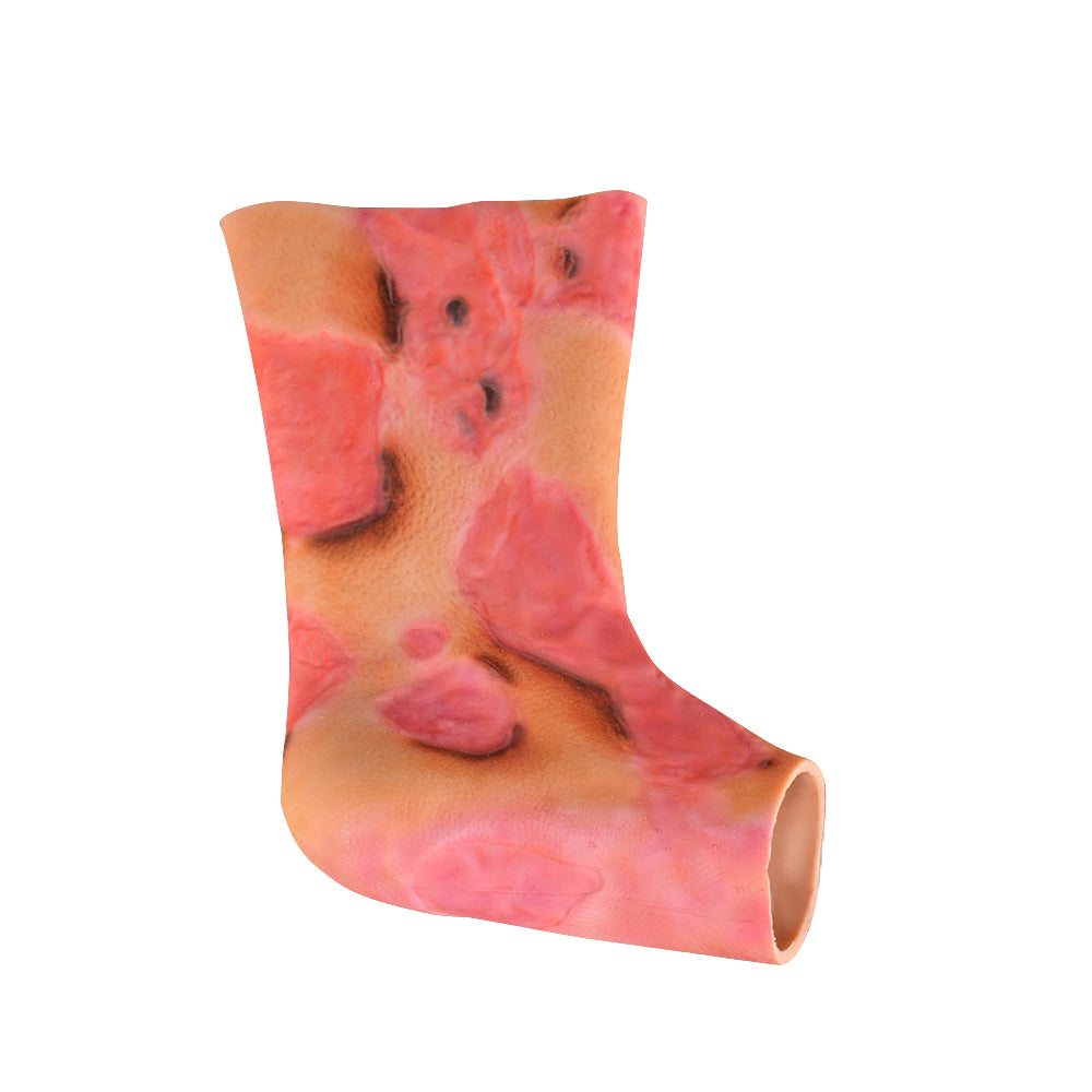 Ankle Burn Simulation Sleeve