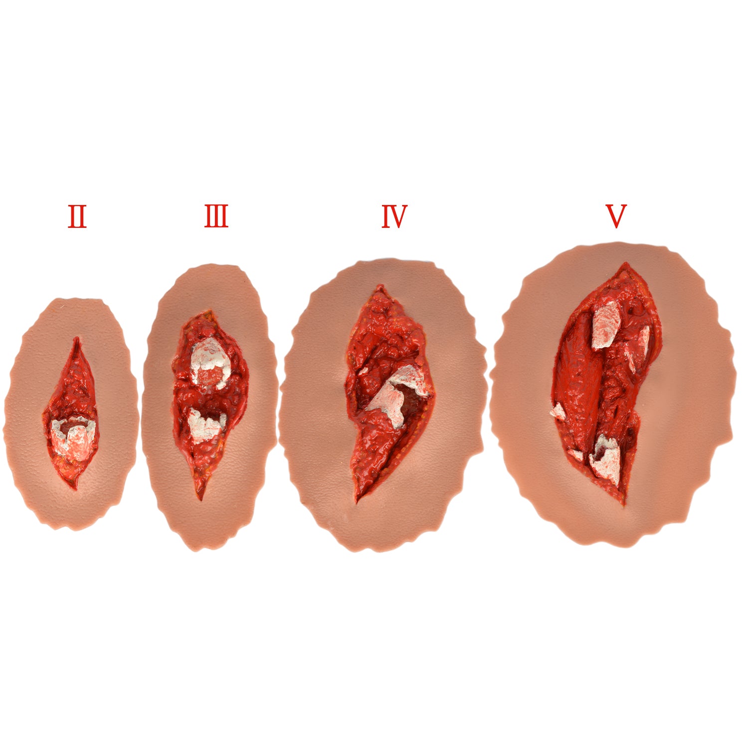Stick-On Open Fracture Moulage Wounds for Fracture Management Training - [shop_medarchitect]