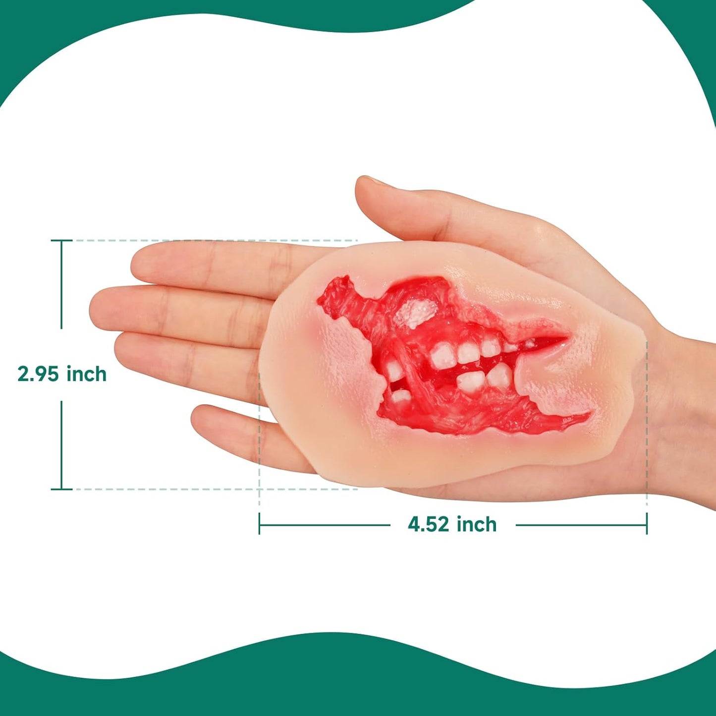Wound Moulage – Maxillofacial Burn Wound Simulation Model