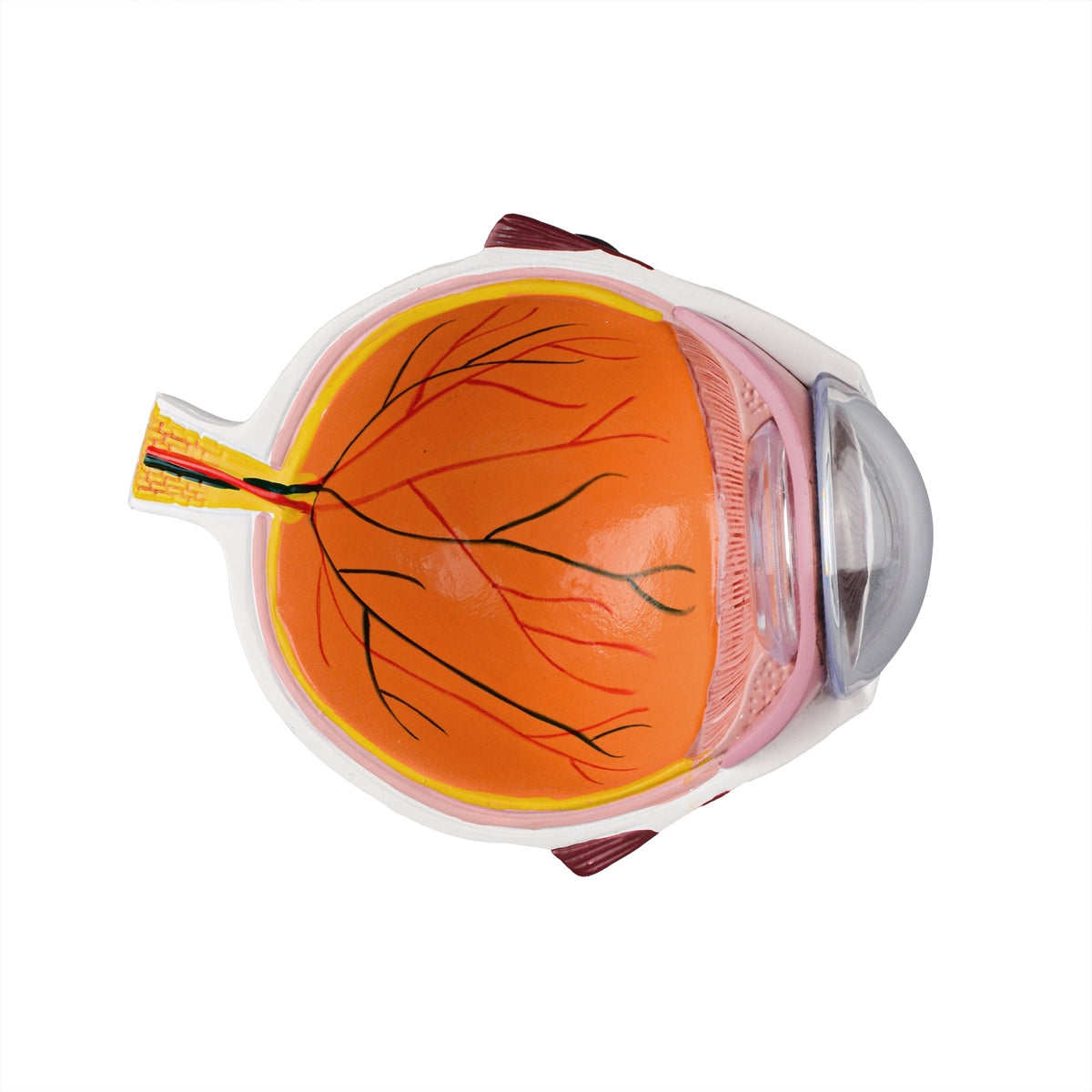 Medical Eye Model Anatomical Eye Model with Cataract – Medarchitect