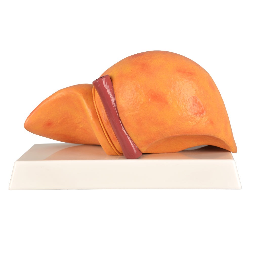 3D Liver Educational Model