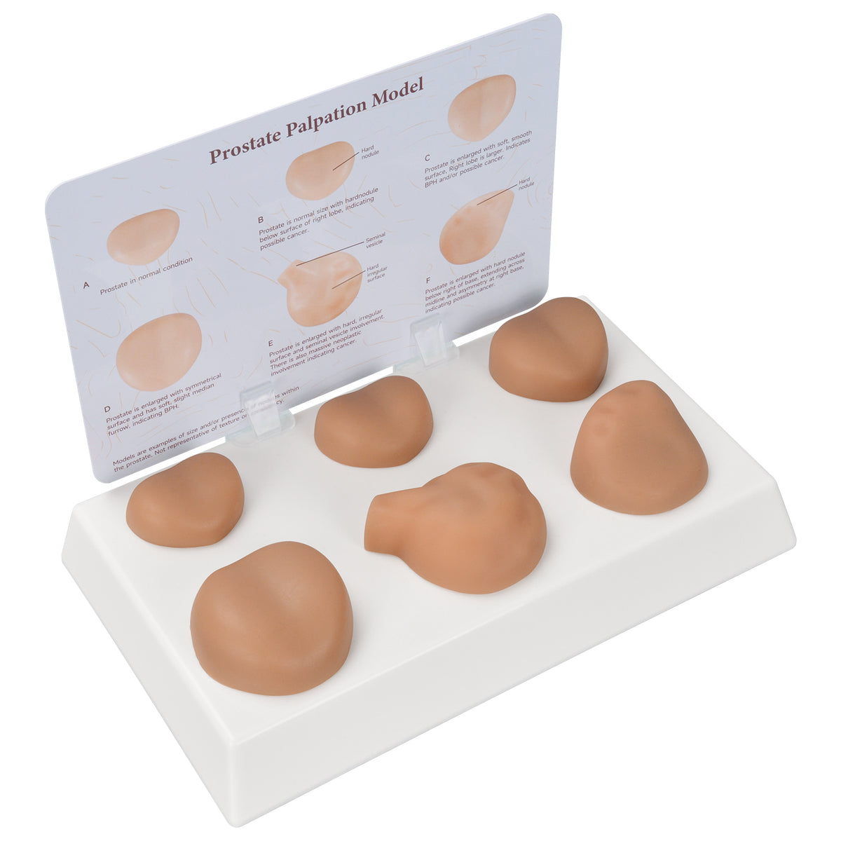 Prostate Scale Model Prostate Palpation Education Model for DRE Training – Medarchitect