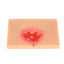 Pressure Ulcer/Bedsore Model Set(Stage 1-4) - [shop_medarchitect]