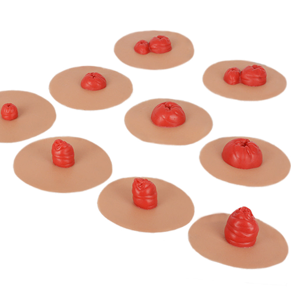 Sticky Stoma Simulation Set (9-Piece In Total)