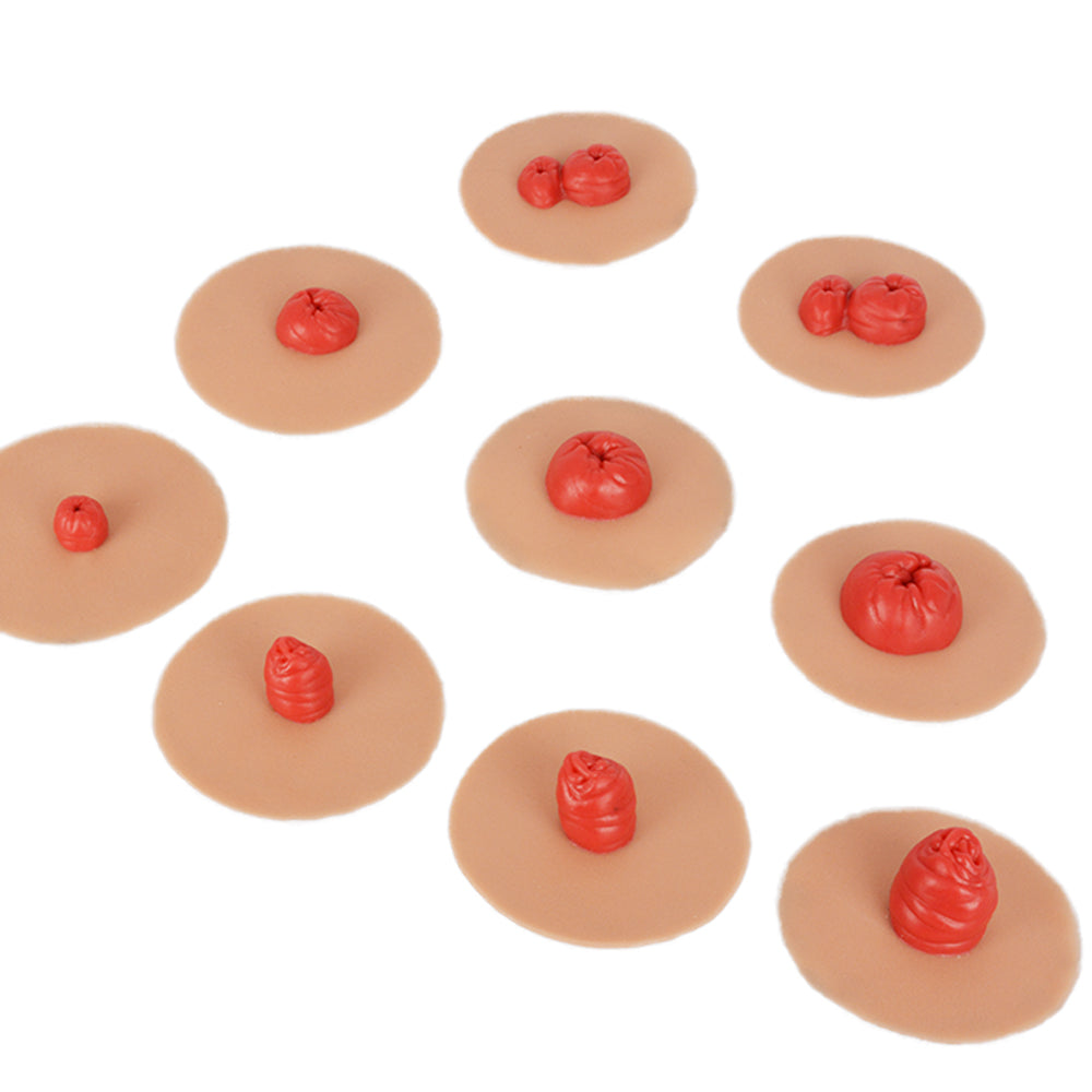 Sticky Similation Stoma Simulation Kit for Ostomy Care Training (9-Piece) – Medarchitect