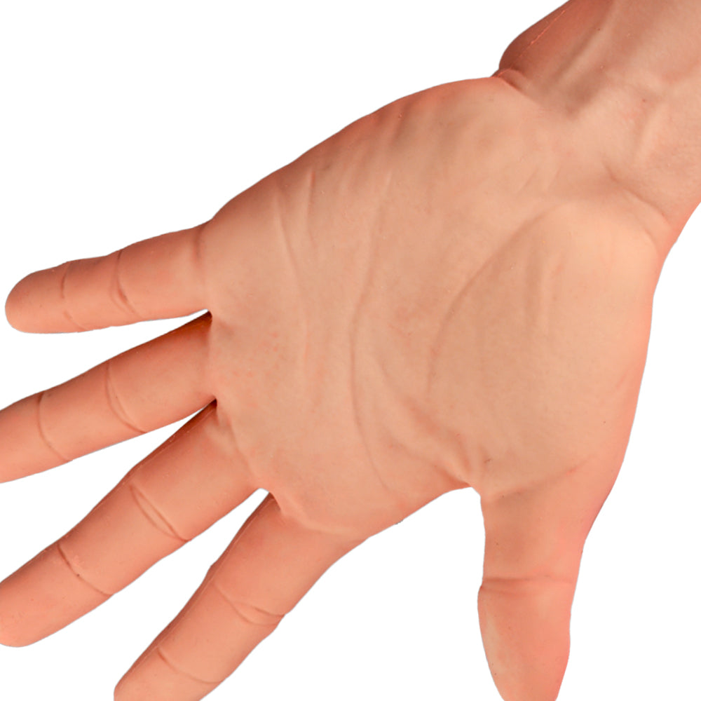 Wearable 3rd Degree Burn Hand Simulator - [shop_medarchitect]