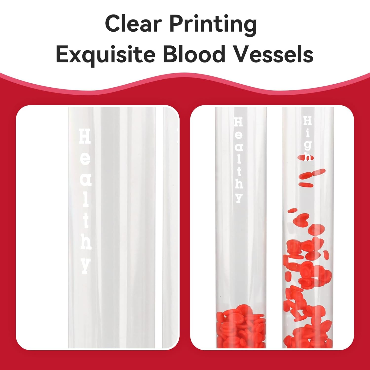 Diabetic Blood Vessel Educational Model - [shop_medarchitect]