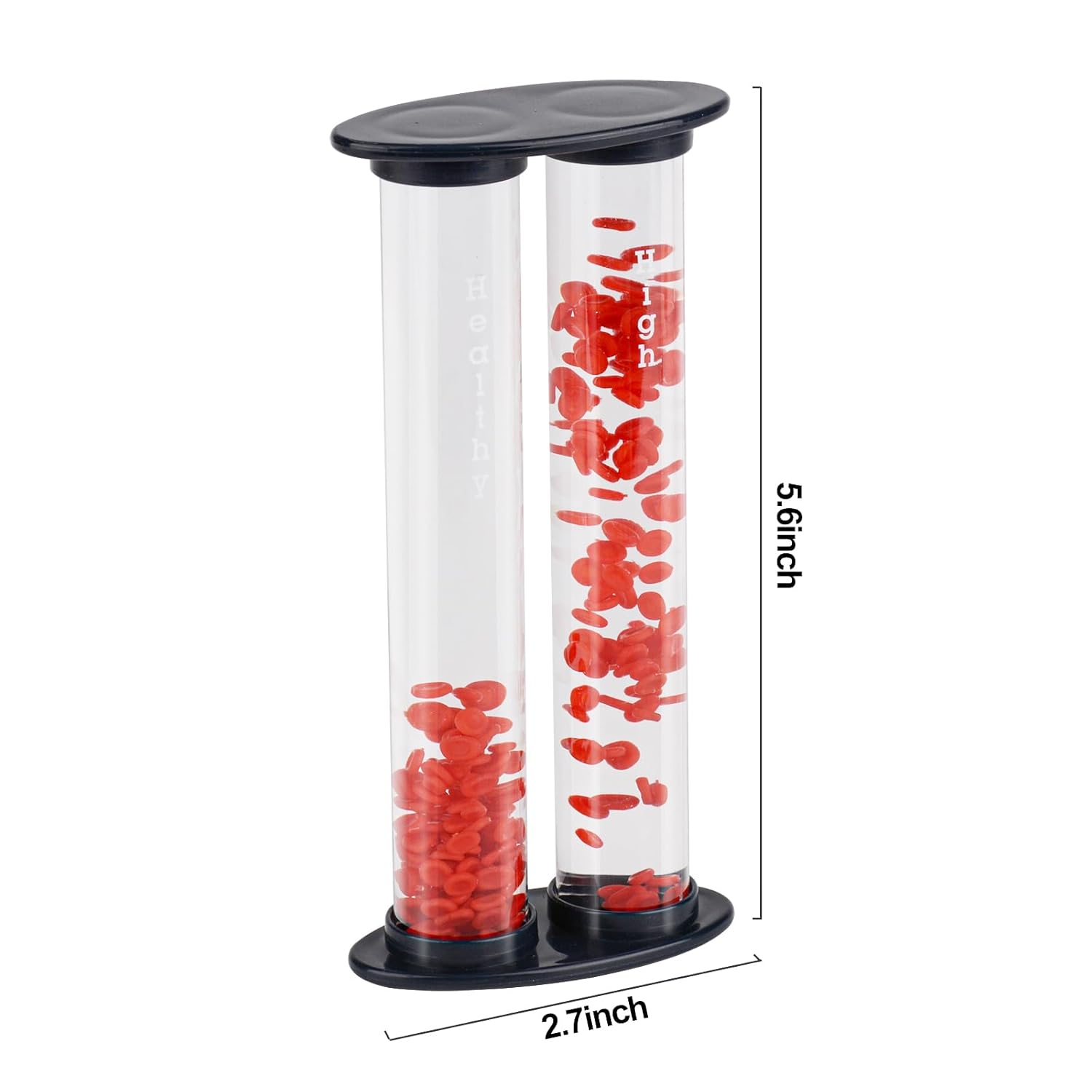 Diabetic Blood Vessel Educational Model - [shop_medarchitect]