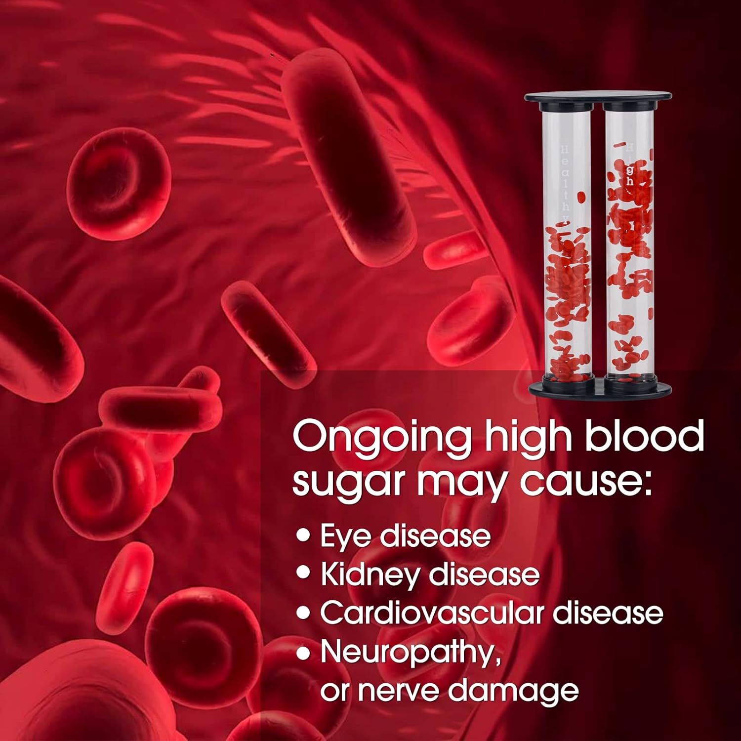 Diabetic Blood Vessel Educational Model - [shop_medarchitect]