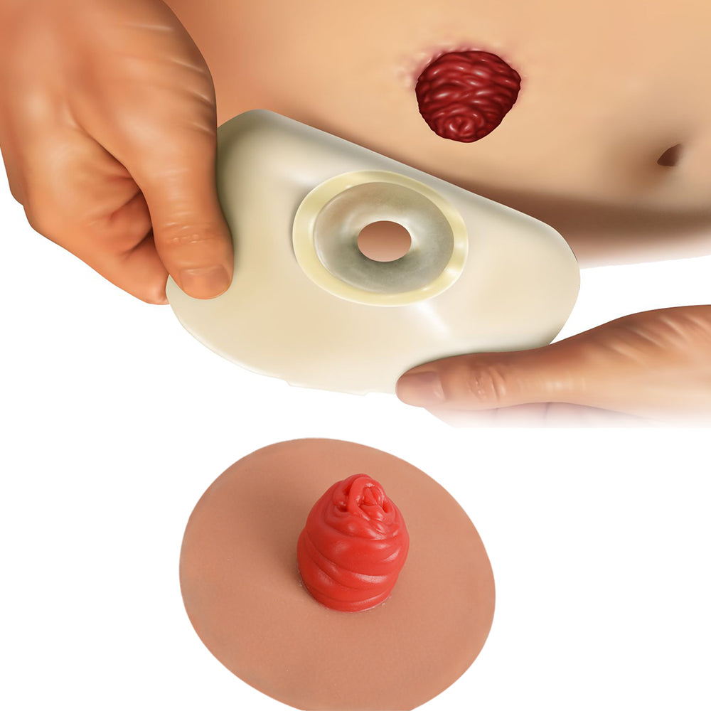 Sticky Similation Stoma Simulation Kit for Ostomy Care Training (9-Piece) – Medarchitect