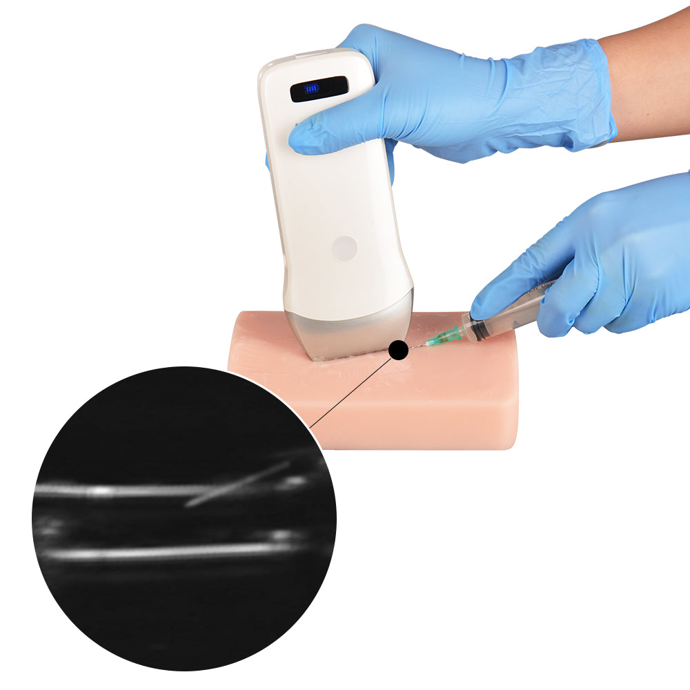 Ultrasound-Guided Vascular Puncture Model