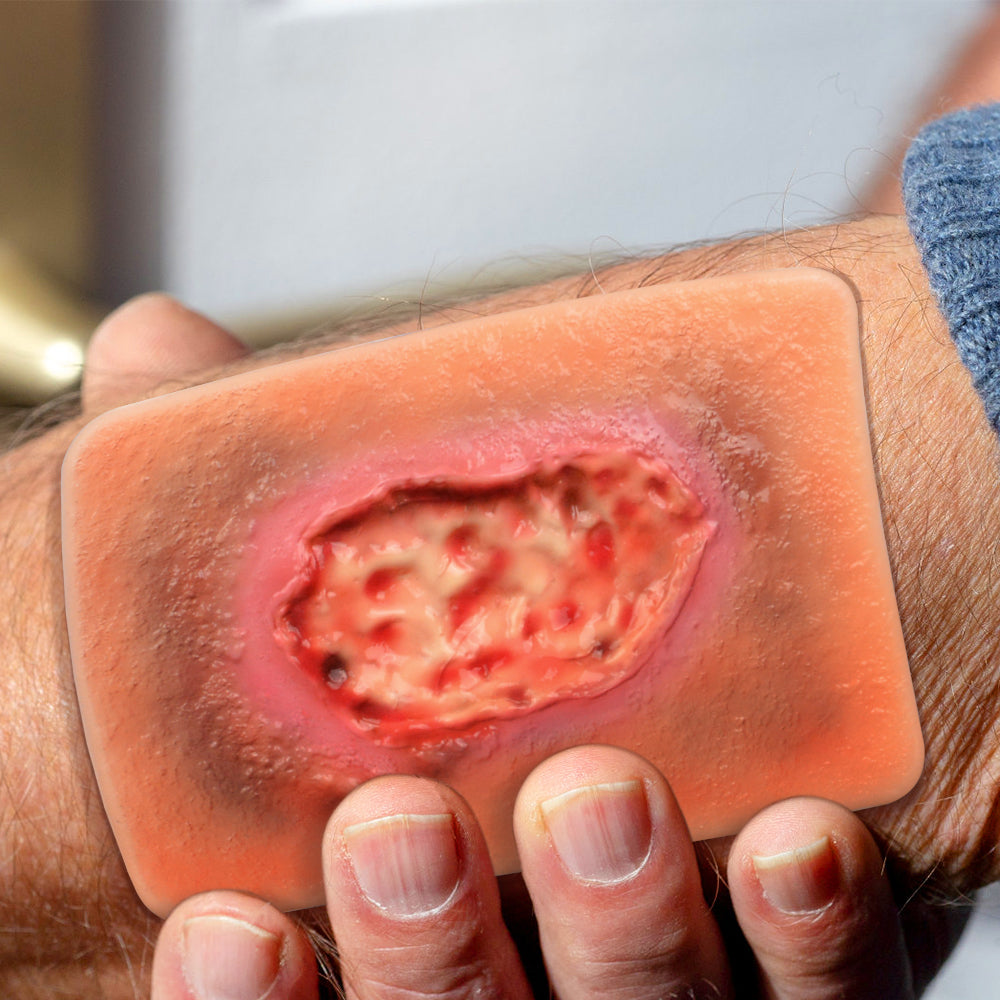 Necrotic Tissue Wound Simulation Model
