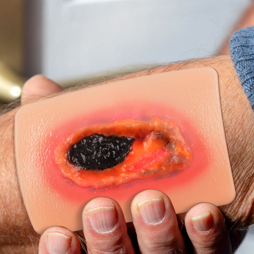 Necrotic Tissue Wound Simulation Model
