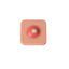 Abscess Wound Training Pad
