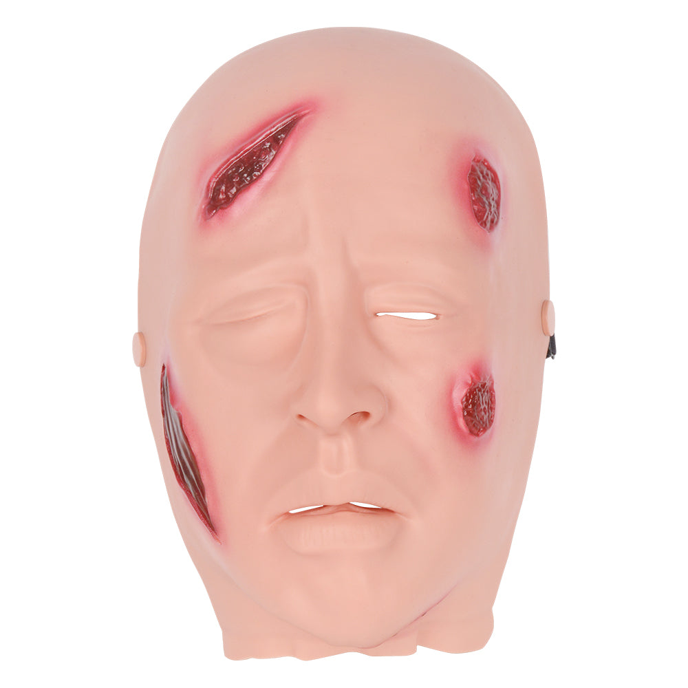 Anthrax Infection Face Moulage Showing Facial Pustules