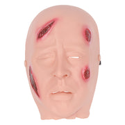 Anthrax Infection Face Moulage Showing Facial Pustules