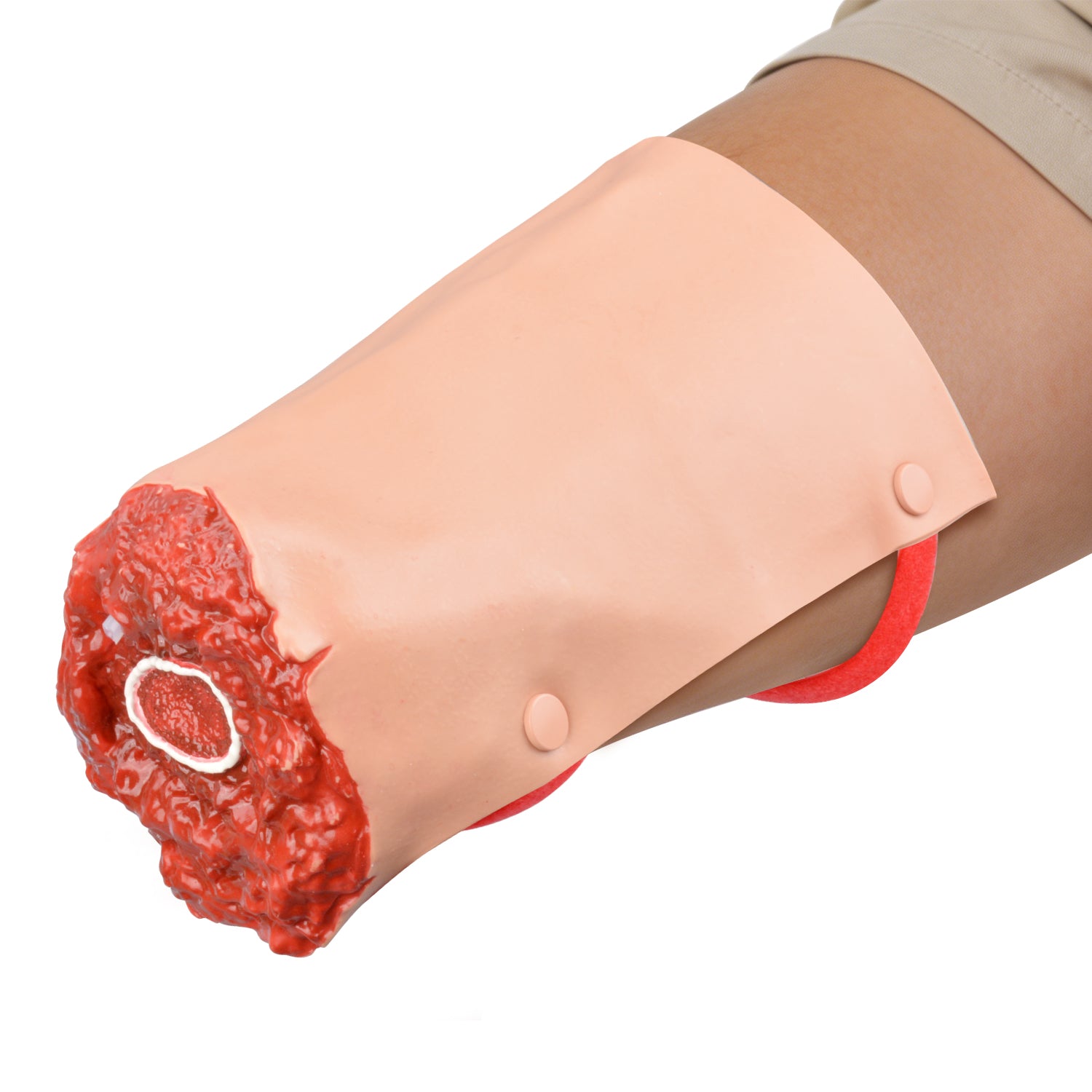 Arm Compound Fracture Wound Model Realistic Training