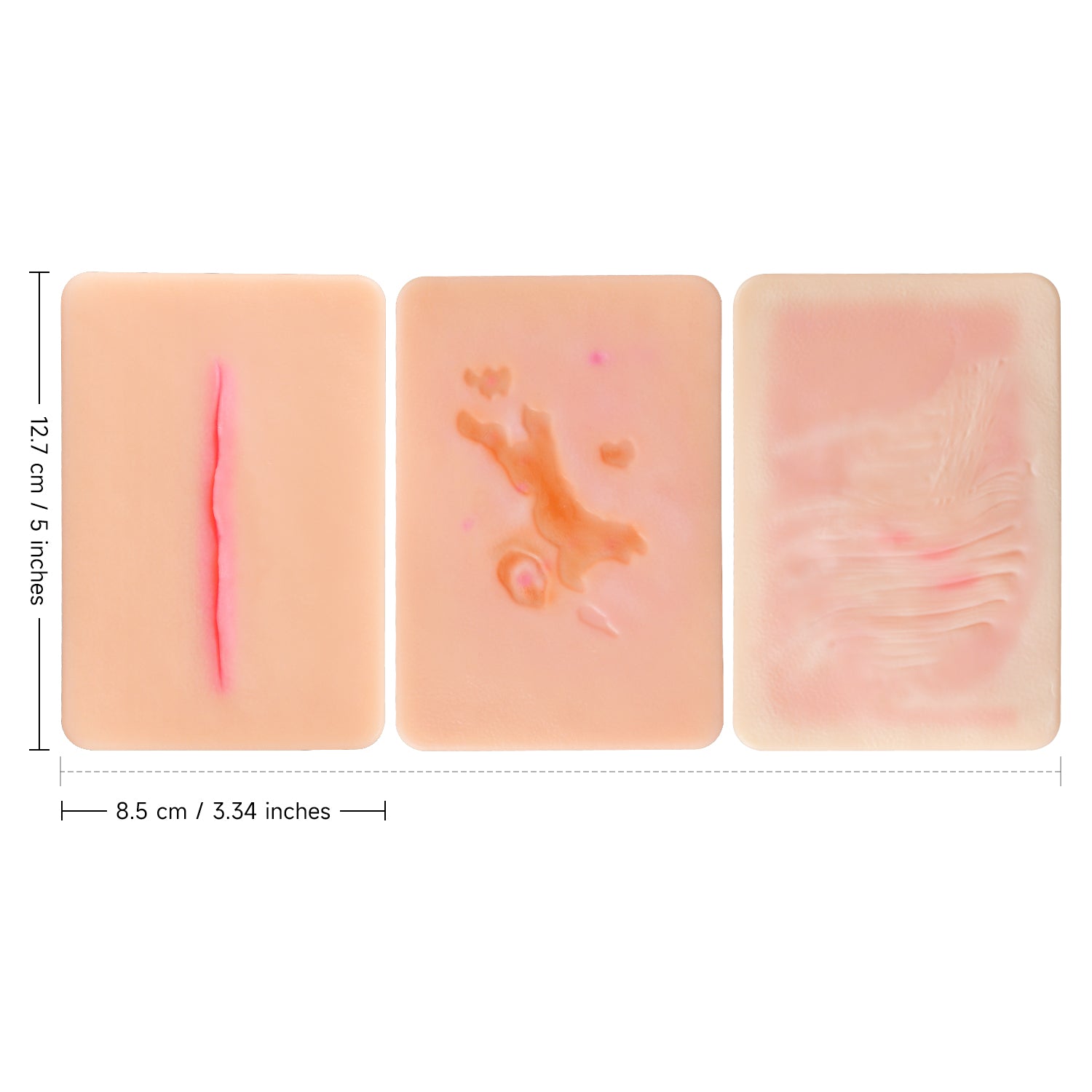 Atrophic Scar Simulation Card for Medical Training