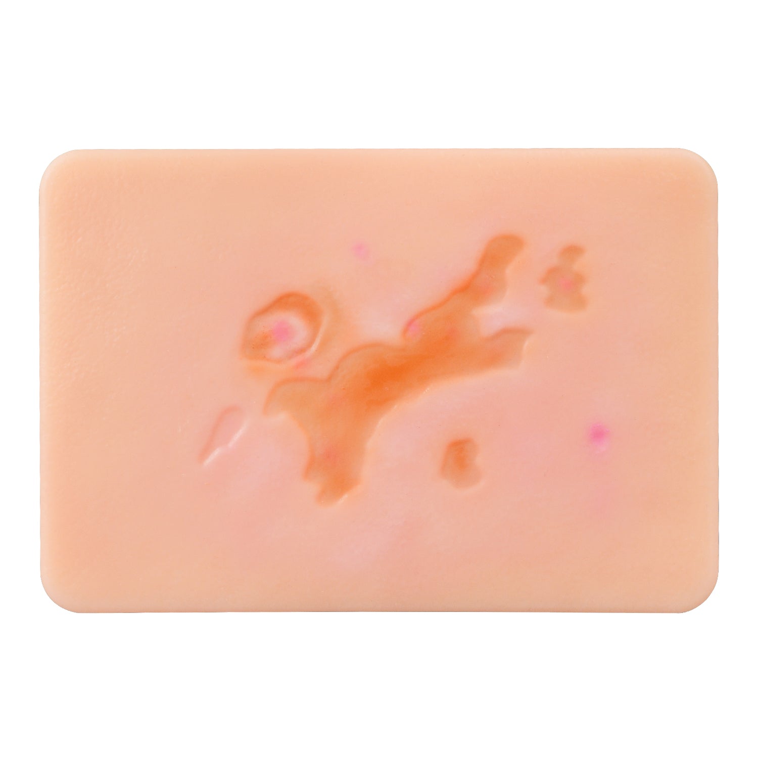 Atrophic Scars Simulation Model Used as Medical Teaching Tool