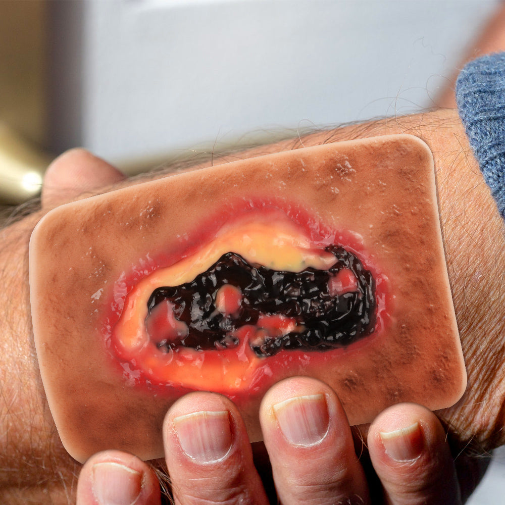Necrotic Tissue Wound Simulation Model