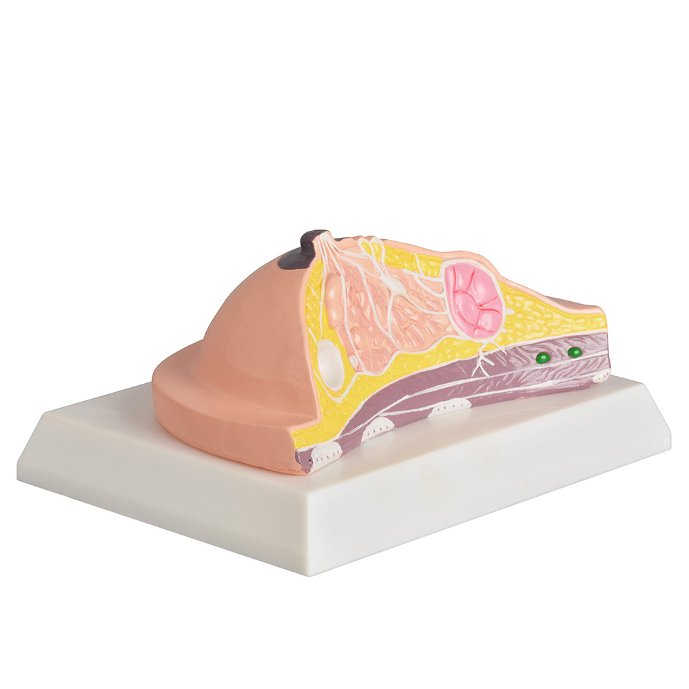 Breast Diseases Teaching Model