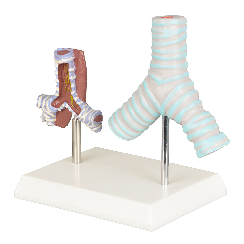 Healthy vs. Smoker Human Bronchi Model – Medarchitect