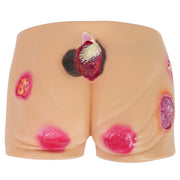 Buttock Pressure Ulcer Nursing Training Model