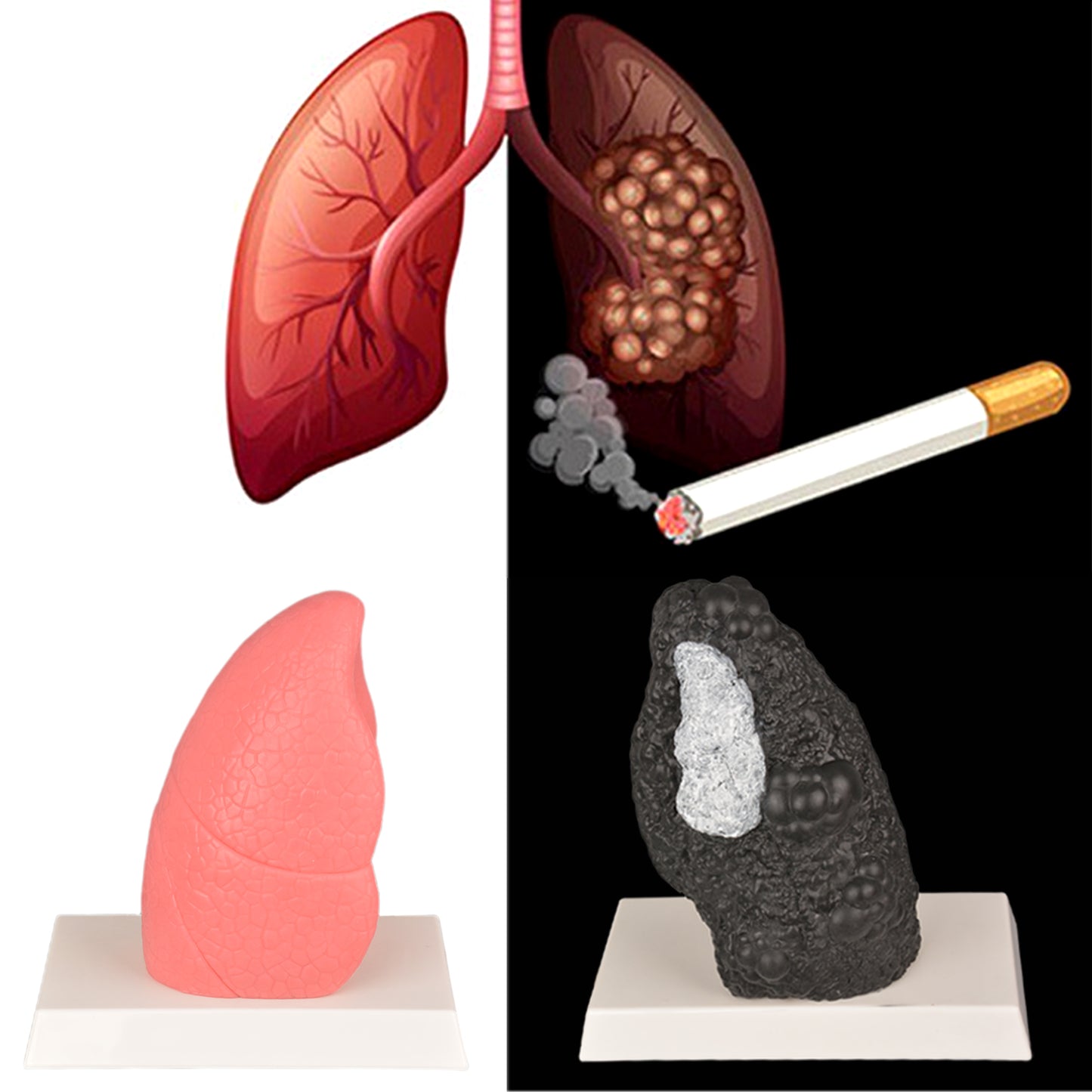 Realistic Lung Anatomy Educational Model